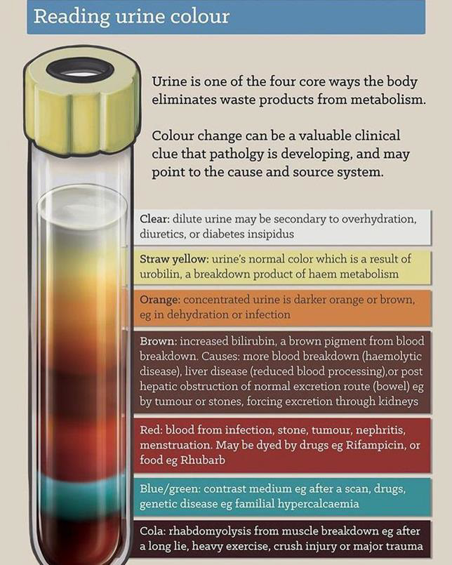 A Peek at Pee What Do the 8 Urine Colors Mean? HC Smart