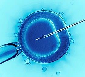 Intracytoplasmic injection is the most commonly used IVF technique. A single sperm cell is injected directly into the cytoplasm of an egg. Wikimedia commons